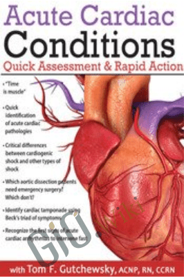 Acute Cardiac Conditions: Quick Assessment & Rapid Action - Tom F. Gutchewsky