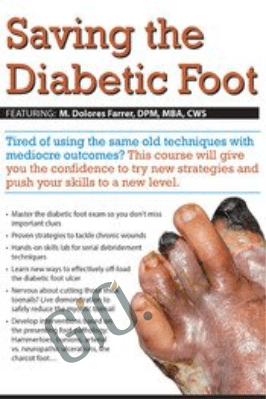 Saving the Diabetic Foot - M. Dolores Farrer